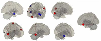 Self-Reported Sleep Quality Across Age Modulates Resting-State Functional Connectivity in Limbic and Fronto-Temporo-Parietal Networks: An Exploratory Cross-Sectional fMRI Study